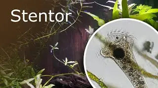 All About Stentor: Anatomy and Reproduction. Stentor Roeselii Under a Microscope (12x-625x)