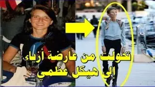 فاليريا ليفتن  من رمز الجمال إلى صرخة تحذير من مرض فقدان الشهية