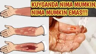 Kuyganda nima qilish mumkin  emas