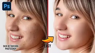 🔥Advance Skin Retouching 2025 | High-End Face Retouching - Best Photoshop Tutorial