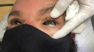 EYEBALL TATTOO BY FREAKUREA #freakurea #eyeball  #eyeballtattoo