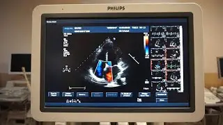 Дополнение к обзору ультразвукового сканера Philips ie33