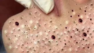 𝐄𝐧𝐣𝐨𝐲 𝐭𝐡𝐞 𝐬𝐮𝐫𝐩𝐫𝐢𝐬𝐞 𝐟𝐫𝐨𝐦 𝐋𝐨𝐚𝐧𝐍𝐠𝐮𝐲𝐞𝐧 #56177965