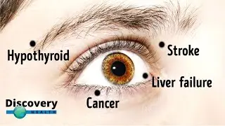 5 Things Your Eyes Are Trying To Tell You About Your Health | Discovery Health