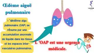 L'œdème aigu pulmonaire (OAP)