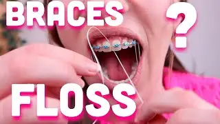 How to floss between your braces