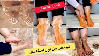 وصفة لتبييض الرجلين وداعا لتشققات وخشونة القدمين  تقشير /تبييض /توريد و ترطيب فوري