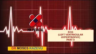 ECG (Left Ventricular hypertrophy) Part 9