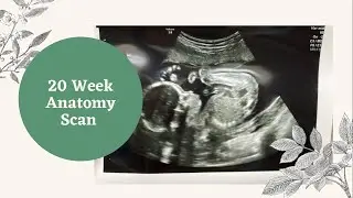 20 Week Anatomy Scan | Boy Mom Vlog