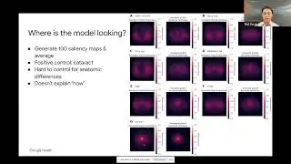 Detection of Diseases and Systemic Biomarkers in Photos of External Eyes (28 Nov 2023)