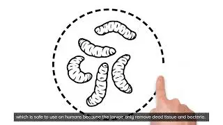 What is Larval Therapy?