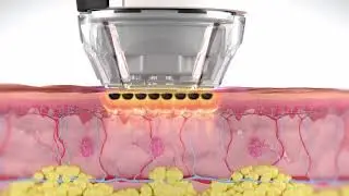 Sublative Biological Animation