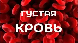 Густая кровь: о чем необходимо знать! Правильное питание Препараты для разжижения крови .