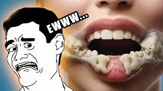 Chewing With Open Mouth Sound