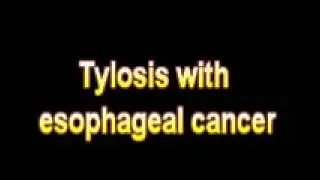 What Is The Definition Of Tylosis with esophageal cancer