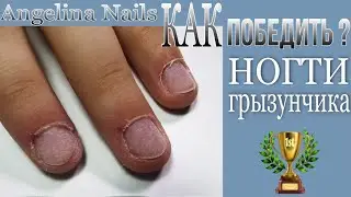 ПРЕОБРАЖЕНИЕ обкусанных ногтей / как работать с ногтями ГРЫЗУНЧИКА / наращивание ногтей без форм !!!