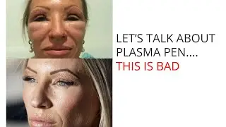 #PlasmaPen Dangers: Why We're Not Offering #FibroBlast or #JPlasma at Our Offices