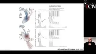 Technical Innovations in Deep Brain Stimulation - Prof. Dr. Med. W.-Julian Neumann