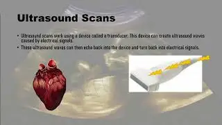 Different types of Medical Scans