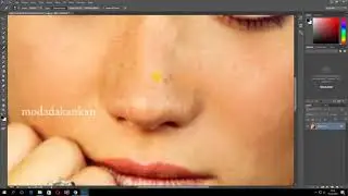 Video 2017 12 15 spothealing