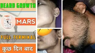 BEARD GROWTH | FULL TERMINAL | अपनी beard को कुछ ही दिनों में terminal करें | Thick your beard