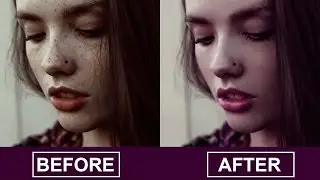 Spot and Acne Removal Techniques : Photoshop Tutorial