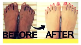 How To Removing Body Tan Instantly at Home Remedy ✨| parlor Like Glow| Priya Creations|