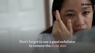 3 Tips to Help You Get Started With Blackhead Removal - Acne & Skin Care