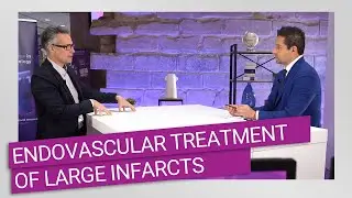 How to manage current challenges in the endovascular treatment of large infarcts?