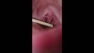 Playing with my tongue and uvula