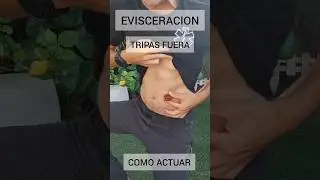 Tripas fuera Como actuar.