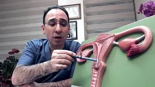 Kadına Bağlı Nedenler? - Op. Dr. Emre Karatekelioğlu