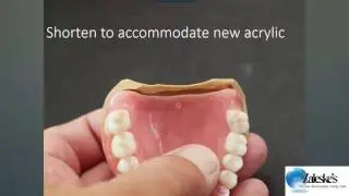 Relocating the PPS post palatal seal post process