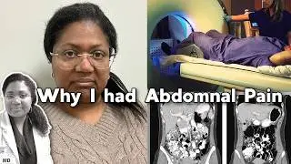 Abdominal Pain Diagnosis: Here's What They Found