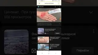 цинокап реклама при сухости кожи рук 2017