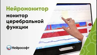 Нейромонитор – монитор церебральной функции с touchscreen-дисплеем на мобильной тележке