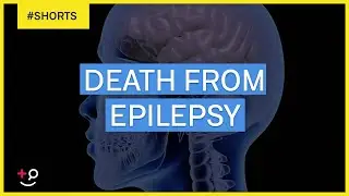 Can You Die From Epilepsy?  
