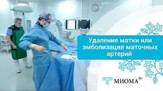 Миома эмболизация маточных артерий или удаление матки