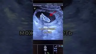 Ножки малыша на УЗИ