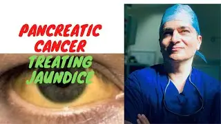 Pancreatic Cancer - Jaundice Treatment (when and how)