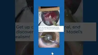 PHACO Training Real Eye vs SimulEYE