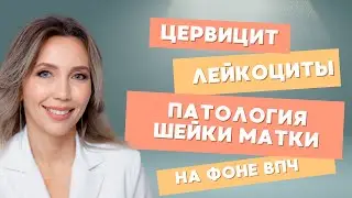 Цервицит, лейкоциты и другая патология шейки матки на фоне ВПЧ-инфекции