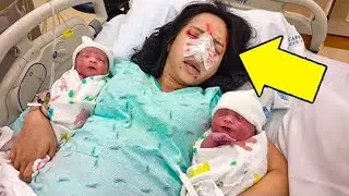 After the twins were born, their mother felt unwell. When the doctor saw the ultrasound, he shouted!