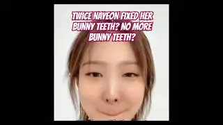 TWICE NAYEON FIXED HER BUNNY TEETH? NO MORE BUNNY TEETH? 