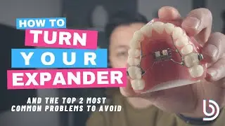 How to turn your expander - Braces 101 - Top Mistakes to avoid with your expander