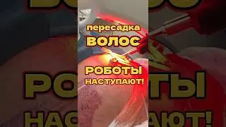 Роботы пересаживают волосы! Хорошо ли это?