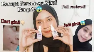 REVIEW SERUM VIRAL SCARLETT!! Bagus gak yaa?🤔 || Syntia Pitaloka #serumscarlett