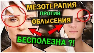МЕЗОТЕРАПИЯ против ОБЛЫСЕНИЯ бесполезна ?! Мезотерапия для женщин и мужчин. Мезотерапия - РАЗВОД !
