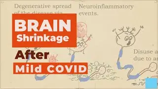 Brain Size Reduction after Mild COVID (Oxford Study)