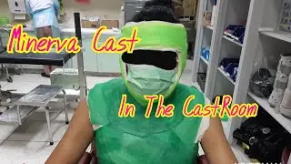 Minerva Cast #:Case non-displace fx.C7,T1,T2
